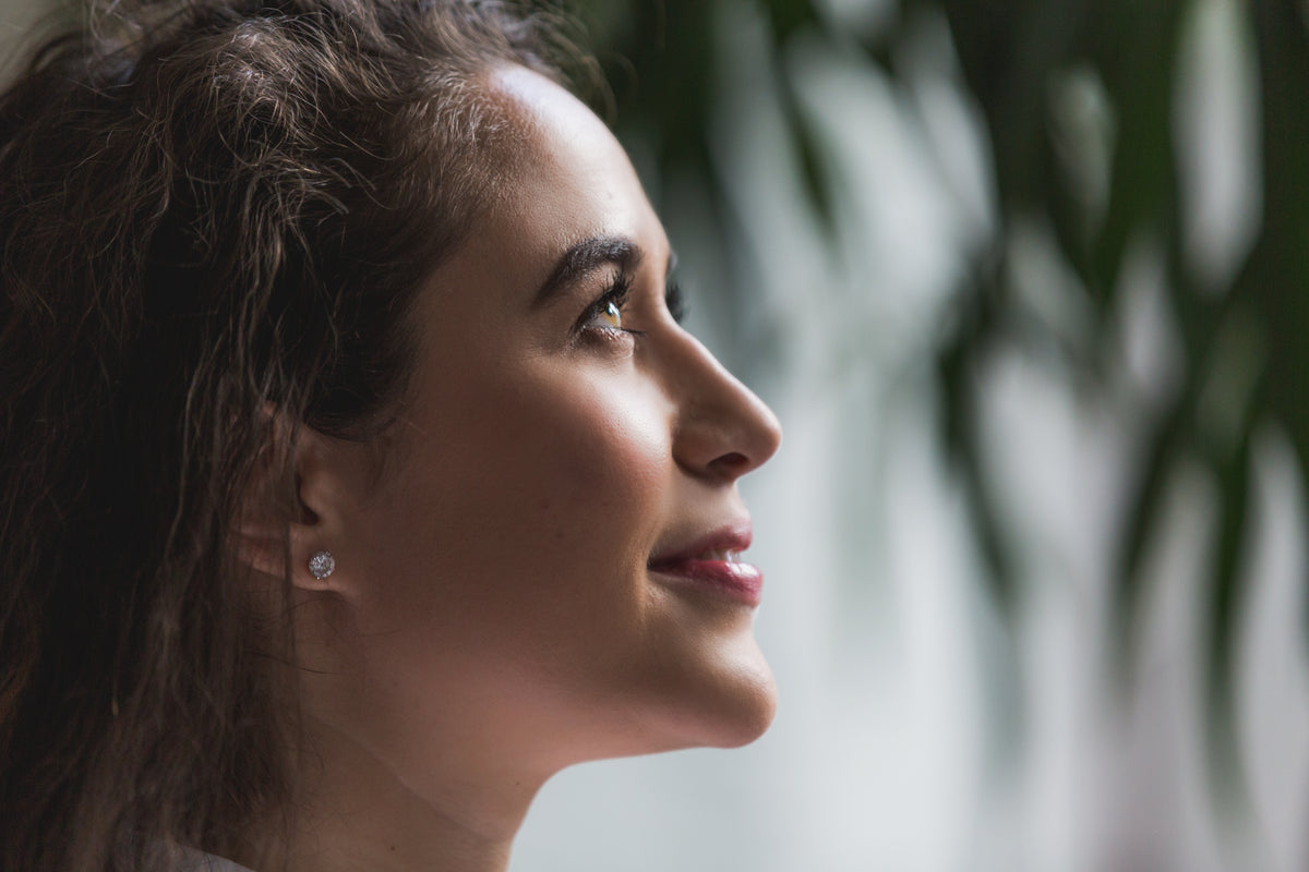 Smoother skin texture and reduced acne scars after microneedling with infrared light therapy